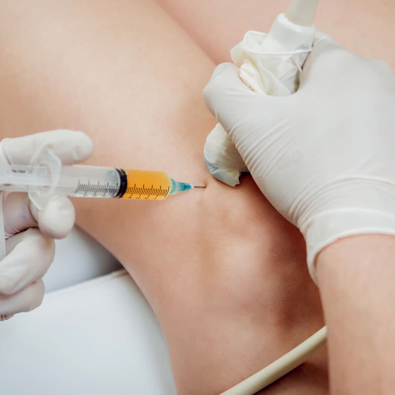 Arthrosmaid injections/hydrogels