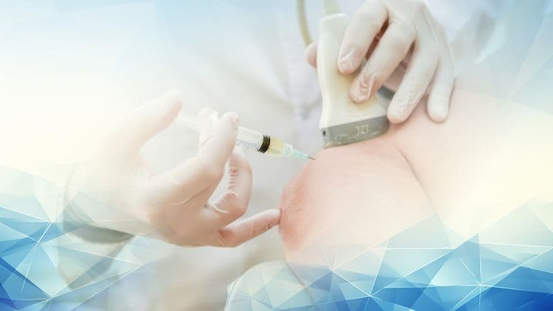 Unravelling Eligibility: Who Can Benefit from Arthrosamid Injections for Knee Osteoarthritis?