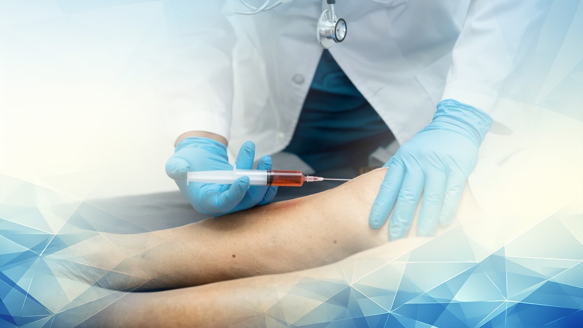 Inside Arthrosamid Injections: The Science and Patient Experience of Hydrogel Treatment for Knee Osteoarthritis