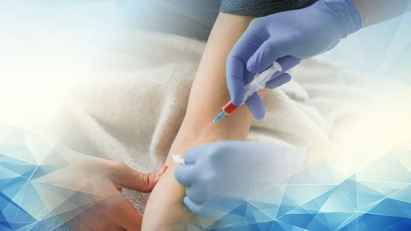 Arthrosamid Injections for Knee Osteoarthritis and Clinic Access Options