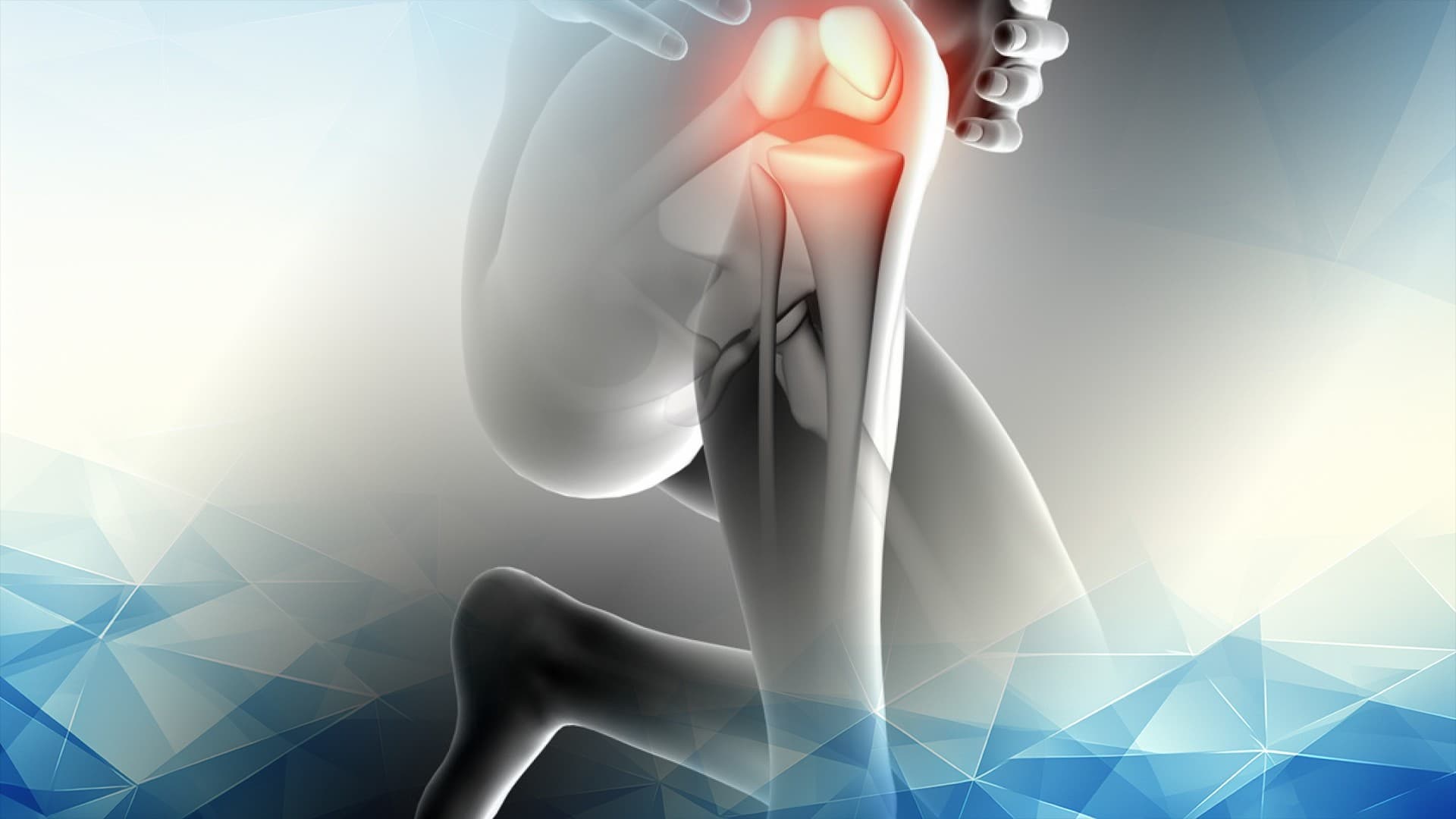 Long-Term Risks and Complications of Untreated Meniscus Tears