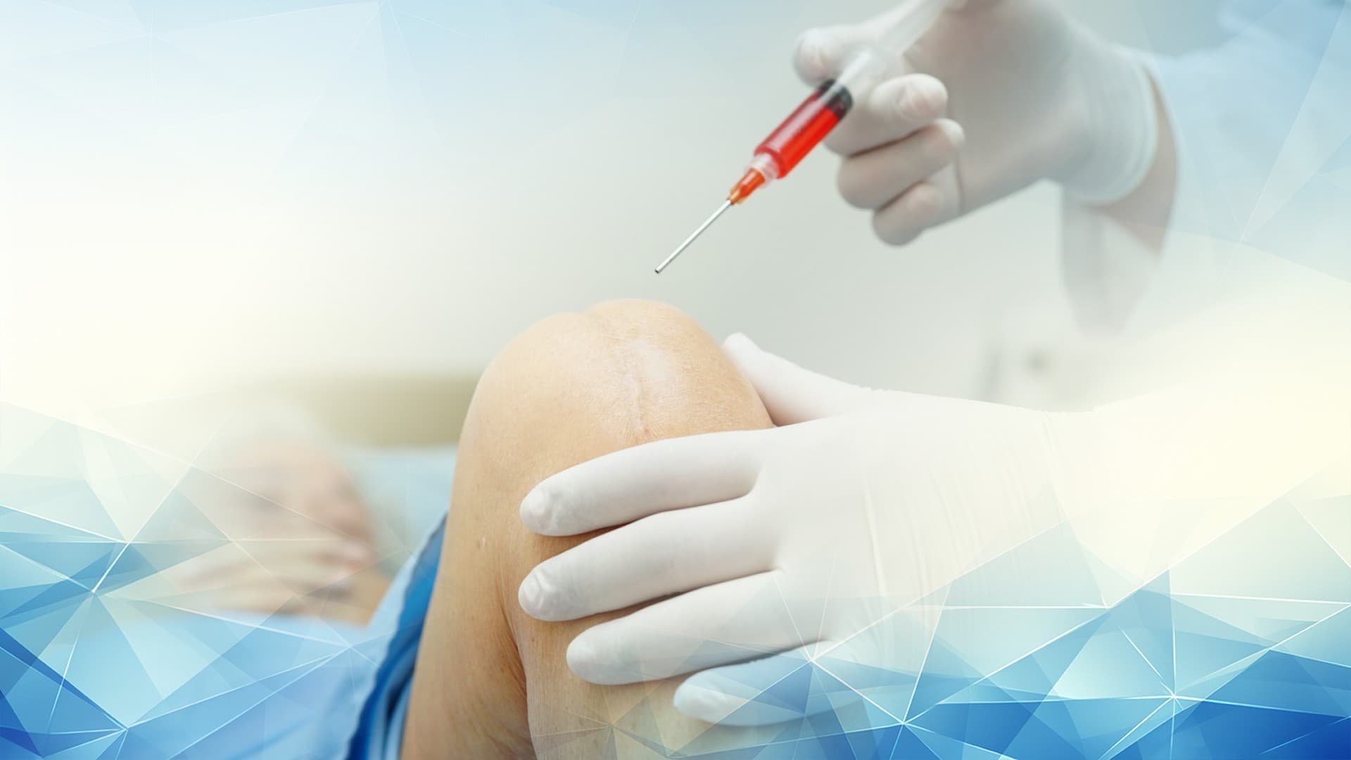 The Science Behind Hyaluronic Acid Injections: How Joint Lubrication Therapy Eases Osteoarthritis Pain Without Surgery