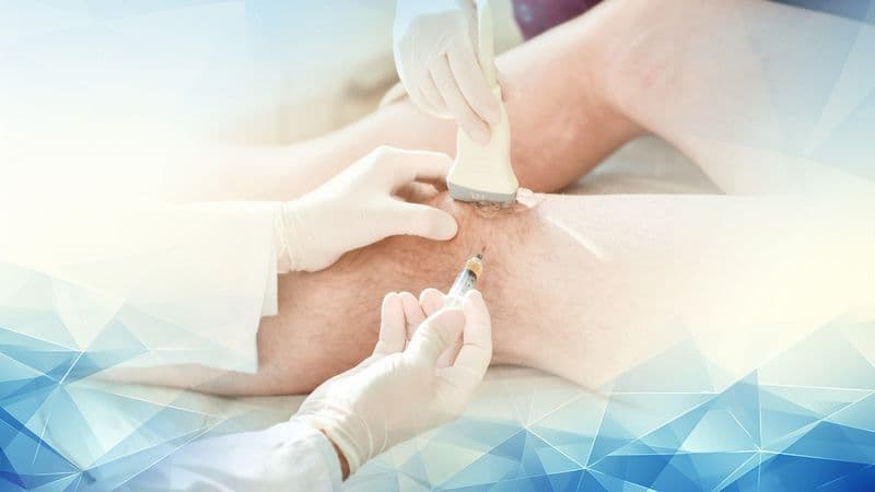 Long lasting relief and costs of Arthrosamid injections for knee osteoarthritis