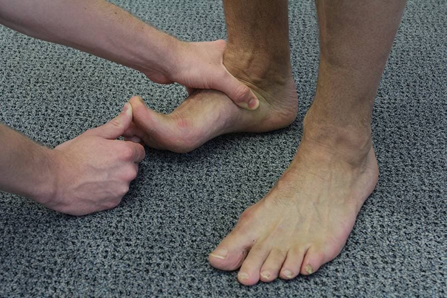 Osteoarthritis Of The Big Toe Joint