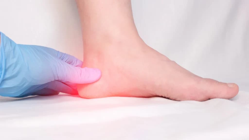 Chronic Foot Discomfort