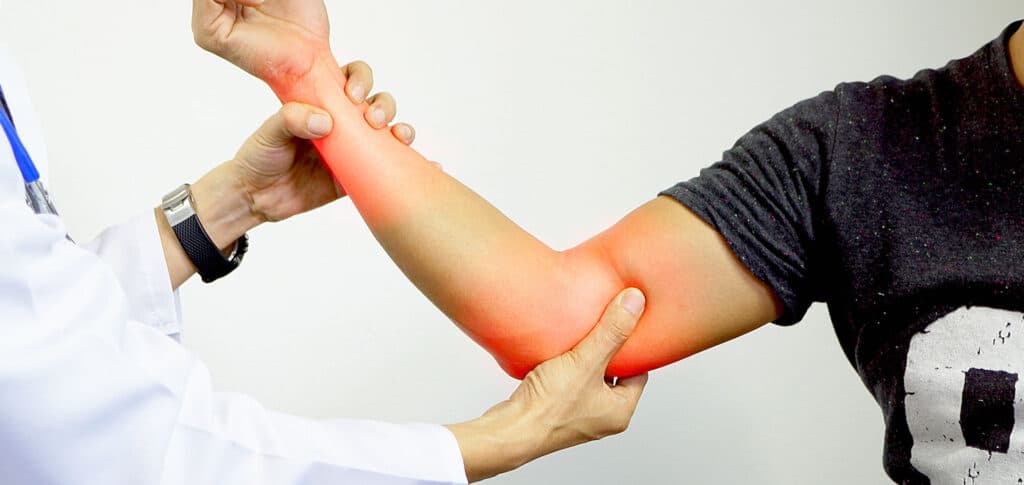 Ulnar Nerve Compression